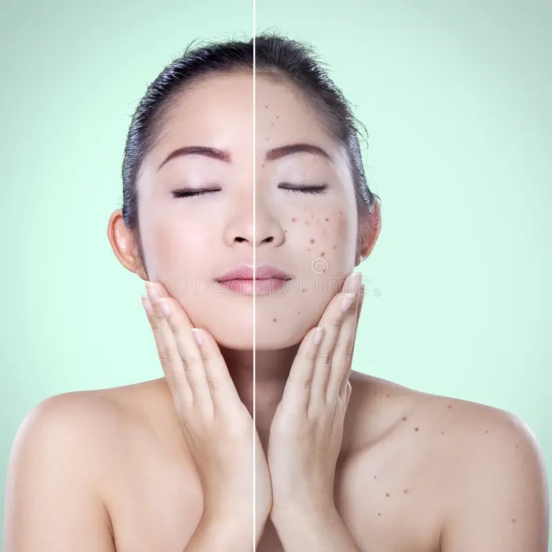 Skin Brightening