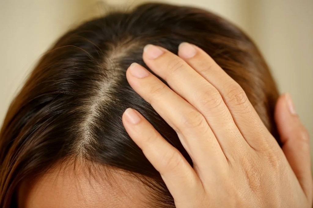 Scalp Therapy