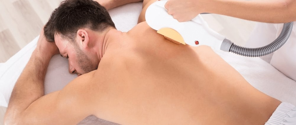 Back Laser Hair Reduction