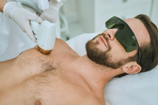 Chest Laser Hair Reduction