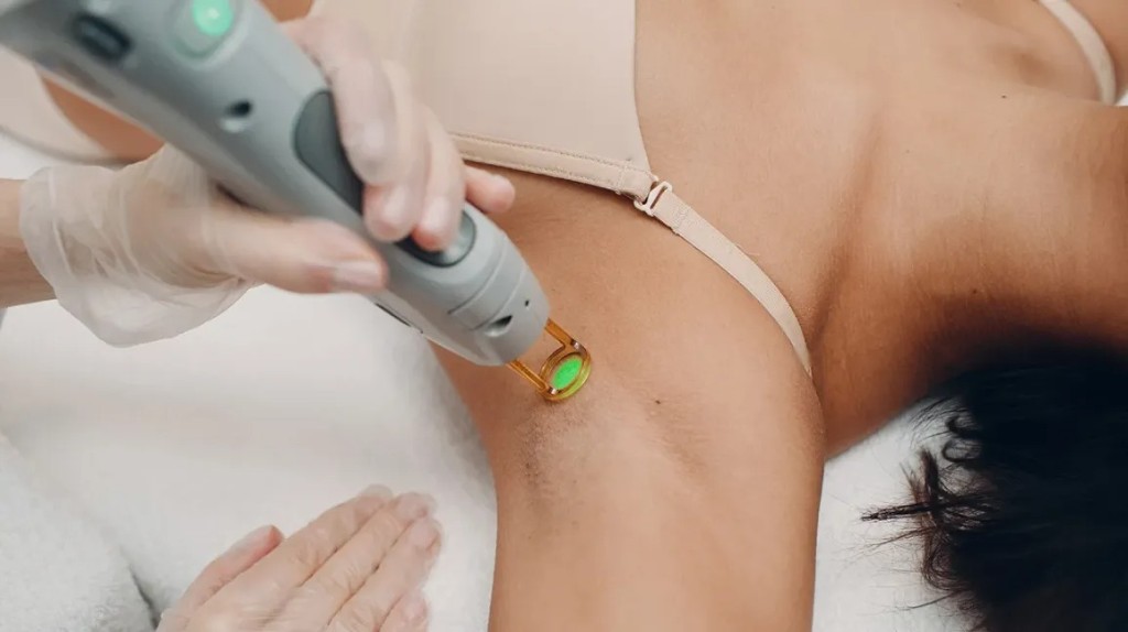 Underarms Laser Hair Reduction