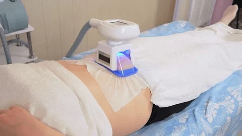 Cryolipolysis