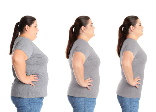 Weight Management